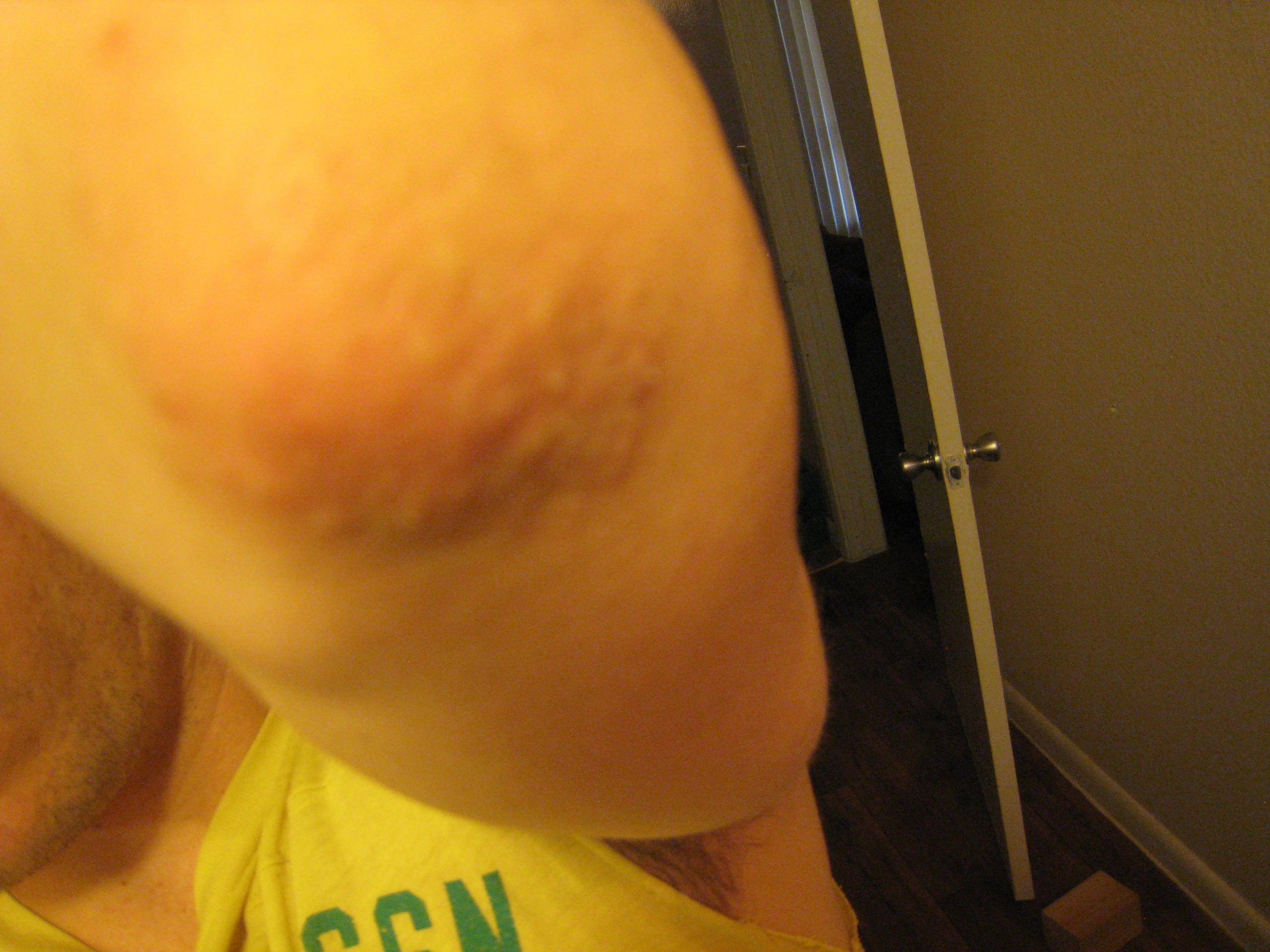 My left elbow itches and there are small skin colored ...