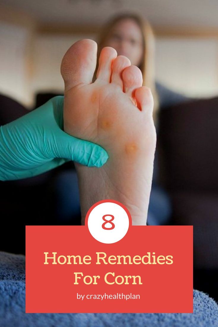 Pin by fusspflegeblog on home remedies in 2021