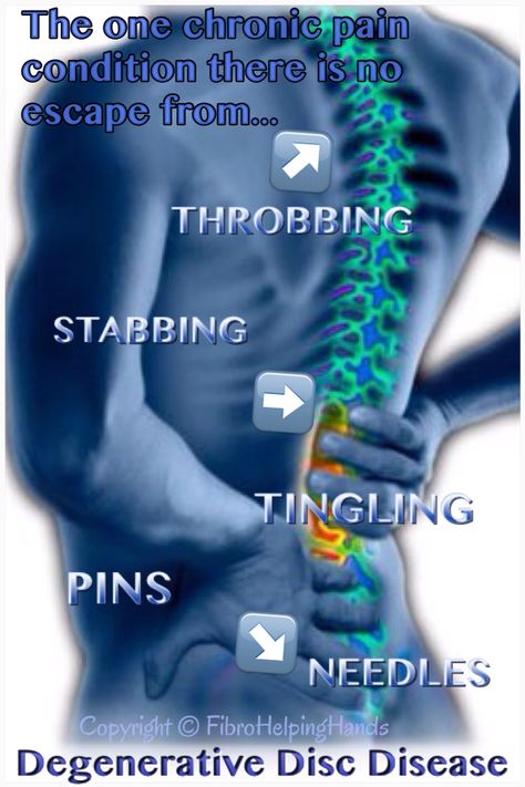 Pin on exercises for back pain