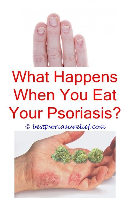 #plaquepsoriasis supplements to take for psoriasis