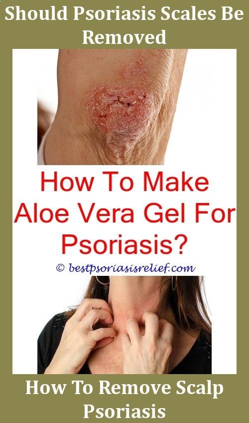 Psoriasis Adalah,eczemapsoriasis how does psoriasis start ...