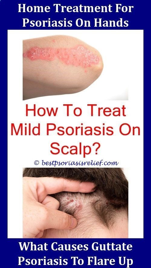 Psoriasis And Mental Healthpsoriasisvseczema pcos and ...