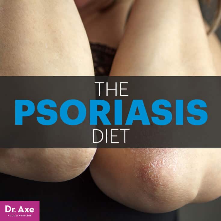 Psoriasis Diet and Natural Treatment Options