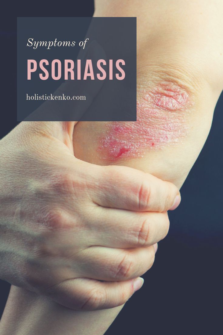 Psoriasis is a chronic inflammatory autoimmune skin disease affecting 2 ...