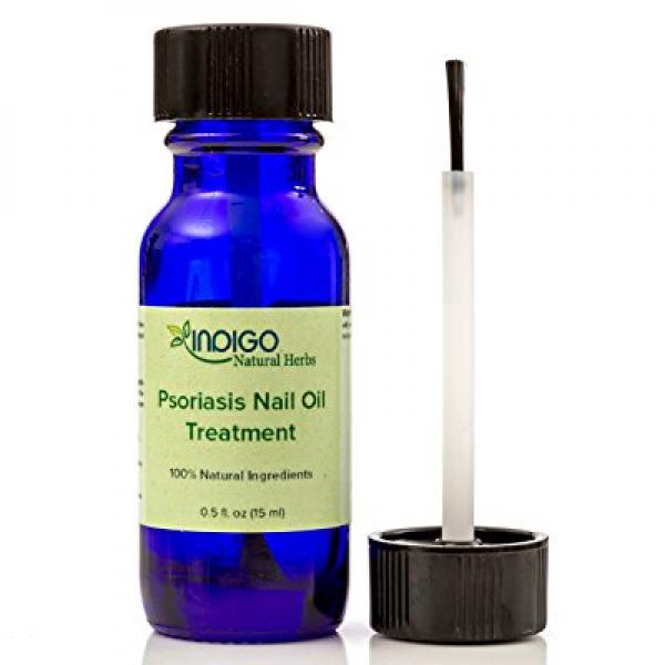 Psoriasis Nail Oil Treatment from Indigo Natural Herbs ...