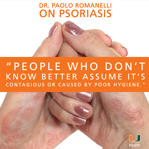 Psoriasis: Should You Shake Hands?