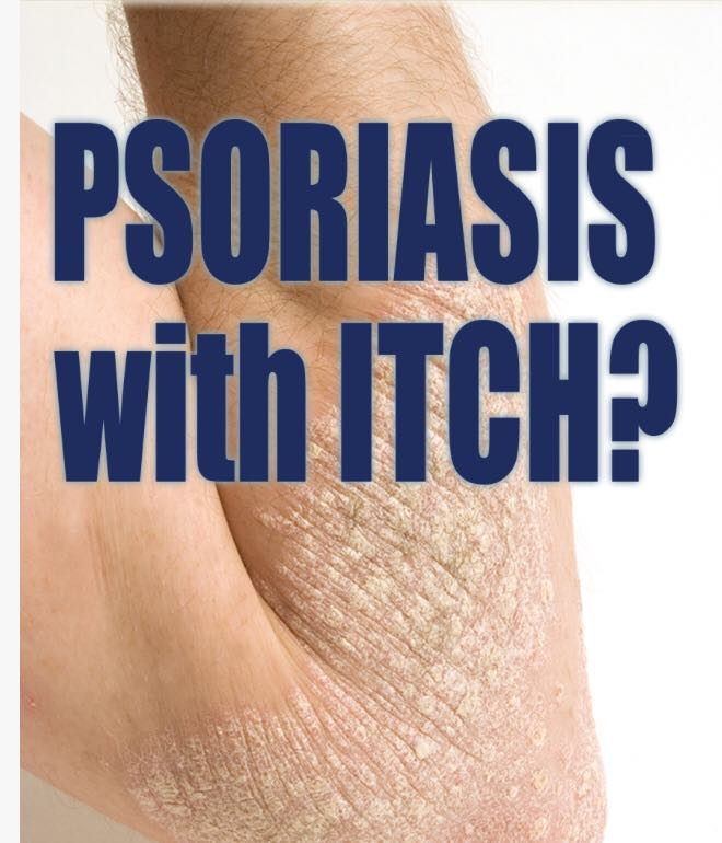 PSORIASIS WITH ITCH? CALL PSORIASIS TREATMENT CENTER OF ...