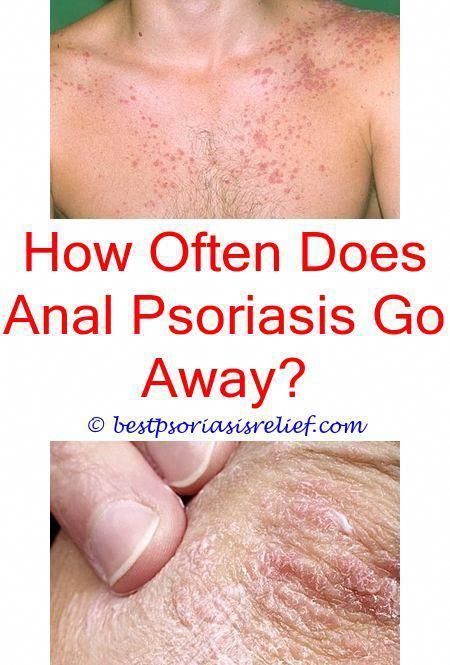 psoriasisimages how does psoriasis look when it heals