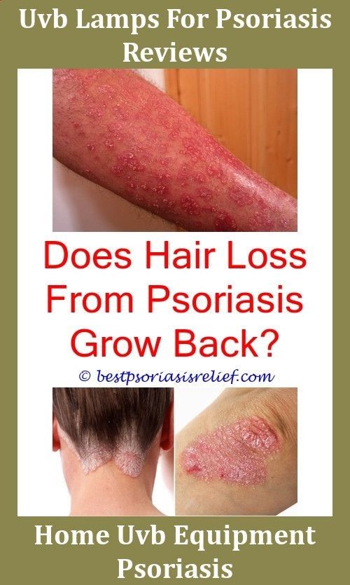 Psoriasismedication Who Gets Psoriasis,howtotreatpsoriasis ...