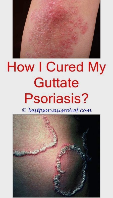 #psoriasisoneyelid what can i use for psoriasis on my face ...