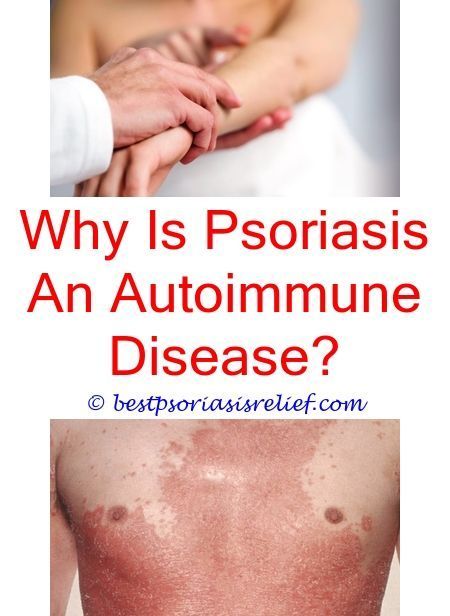 #psoriasisvulgaris wild naturals eczema &  psoriasis ...