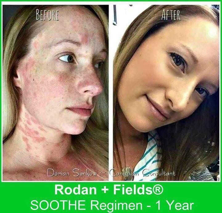 Rodan and fields soothe image by Beth May Hinkle on Rodan ...