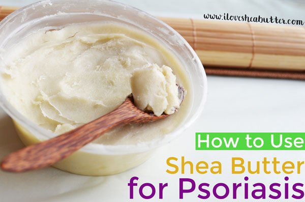 Shea Butter for Psoriasis