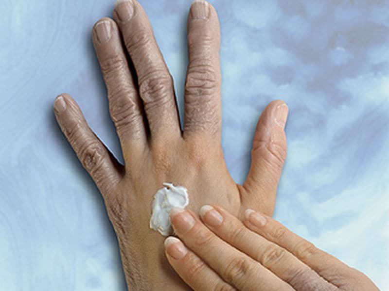 Skin Cream May Offer New Treatment Option for Psoriasis