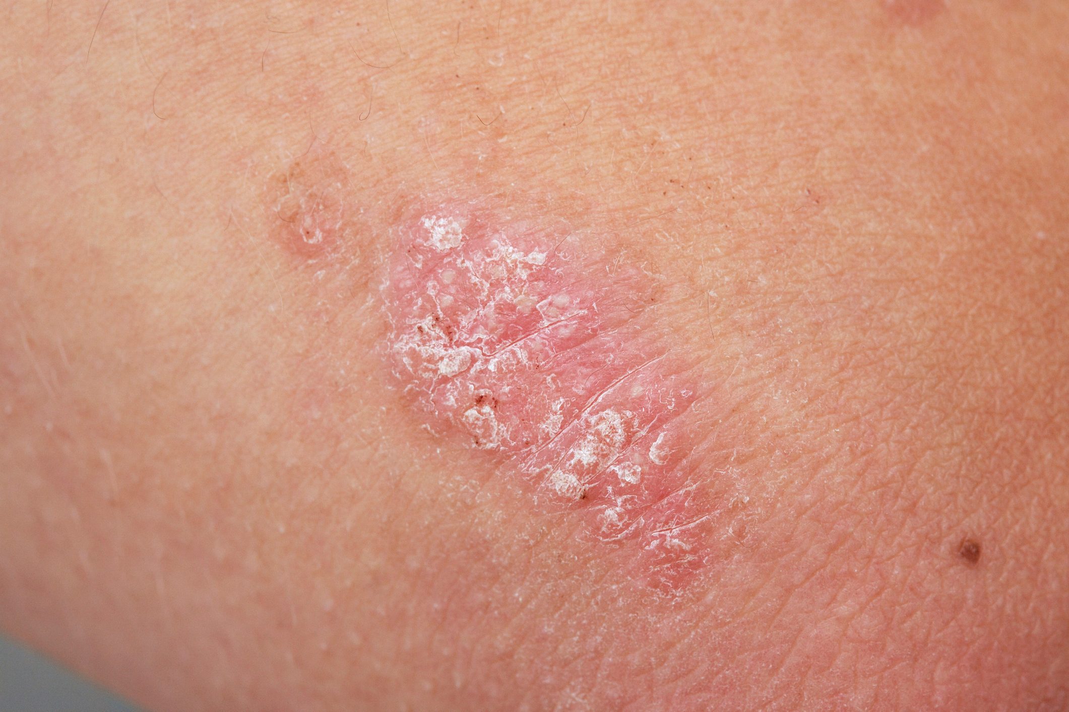Skin Disease: Body Diseases Your Skin Reveals