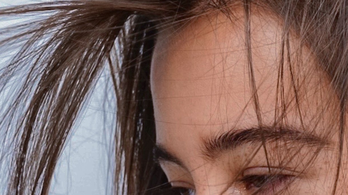Smelly Scalp: Why Does It Happen, and How Can You Fix It?