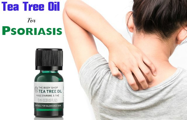 Tea tree oil for scalp psoriasis