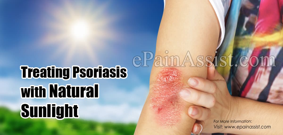 Treating Psoriasis with Natural Sunlight &  Phototherapy