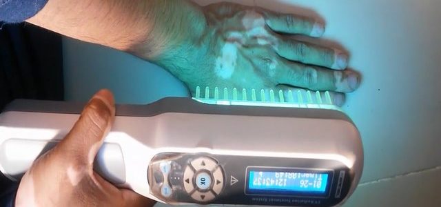 Uv Treatment For Psoriasis At Home