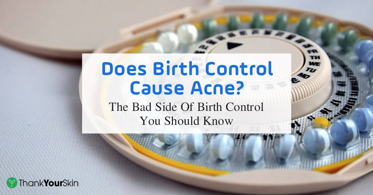 Warning: Does Birth Control Cause Acne?