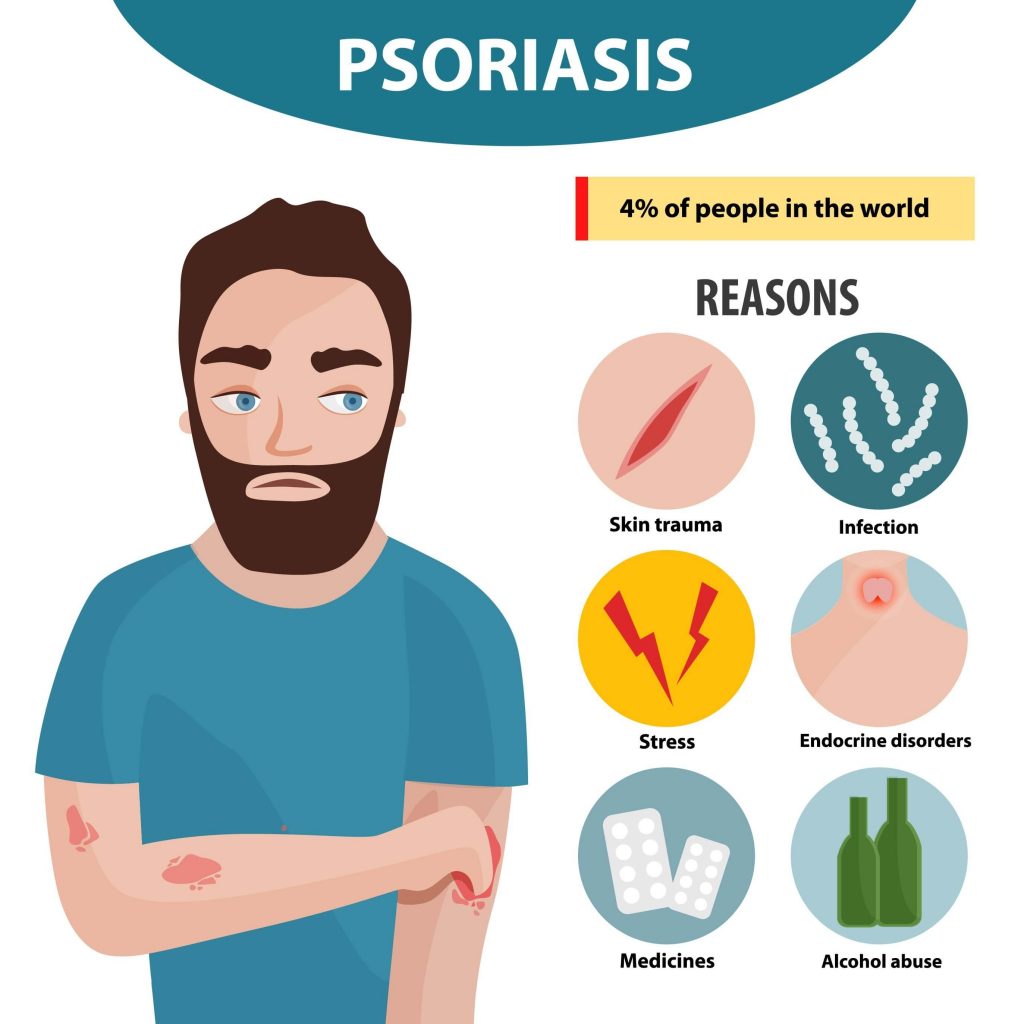 What are the Causes of Psoriasis?
