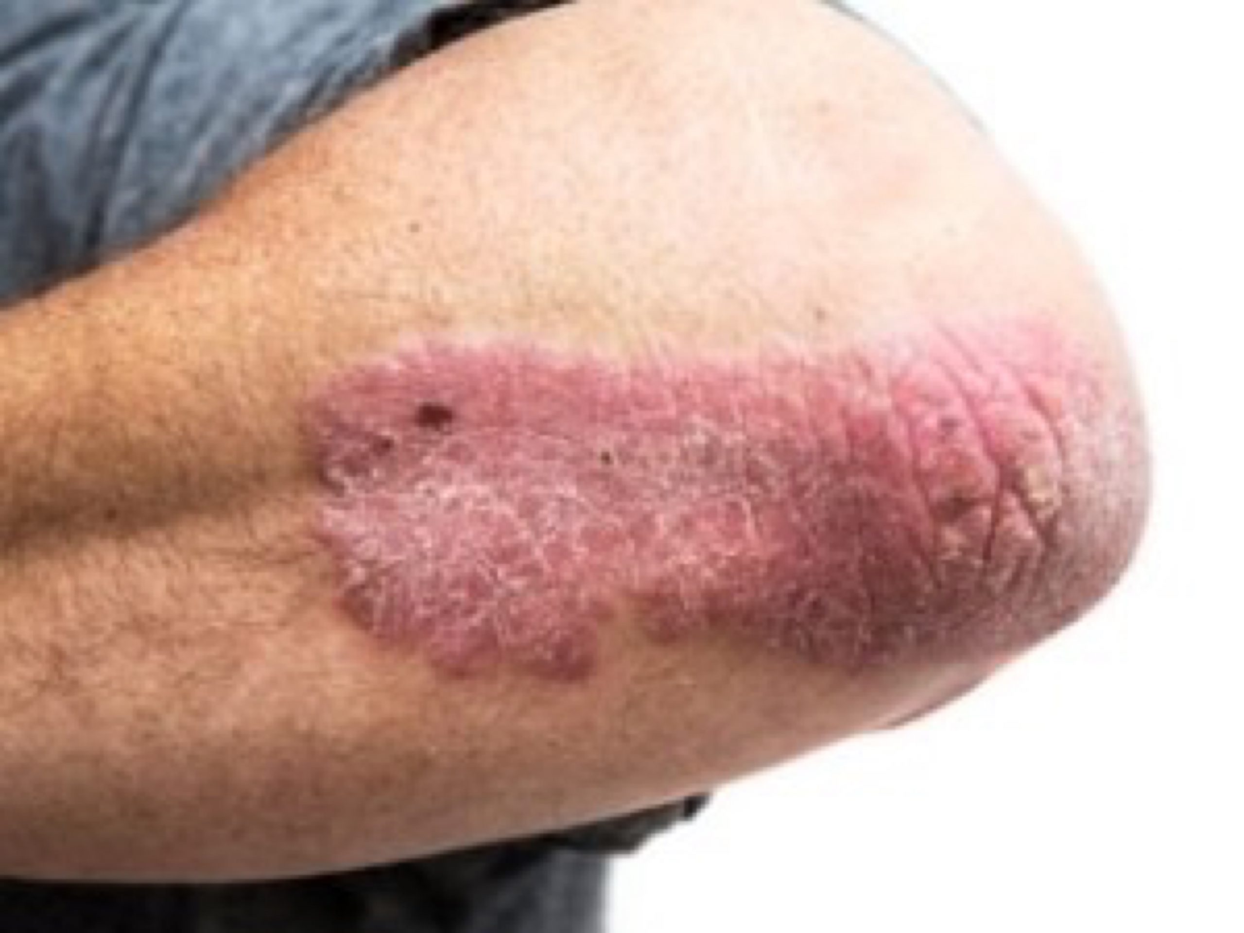 What Causes Skin To Itch?