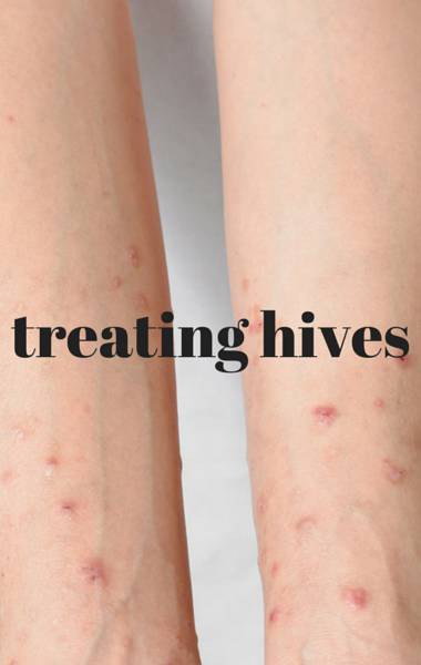 What Do Hives Look Like On The Skin
