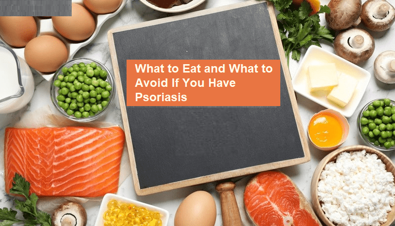 What To Eat And What To Avoid If You Have Psoriasis
