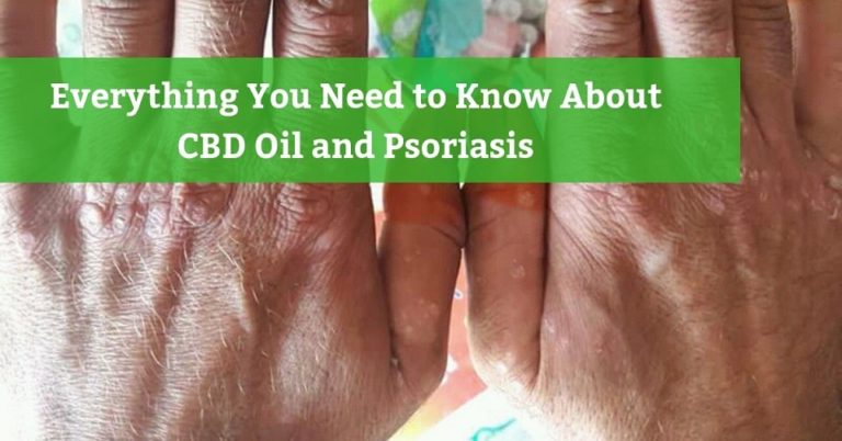 What Type And.dosage Of Cbd Oil Do I Need For Psoriasis ...