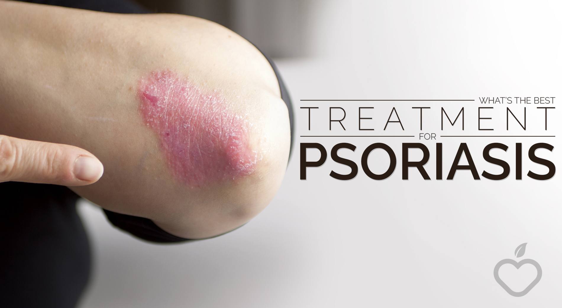 Whatâs The Best Treatment For Psoriasis