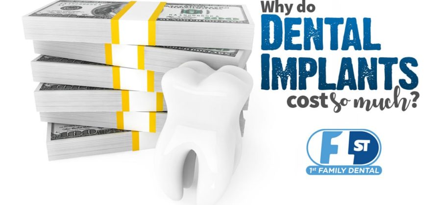 Why Do Dental Implants Cost So Much?