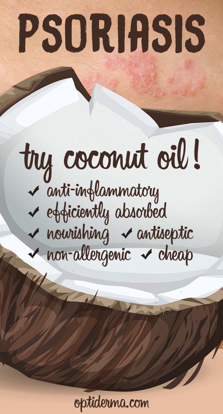 Why Use Coconut Oil for Psoriasis? Learn about the benefits of coconut ...