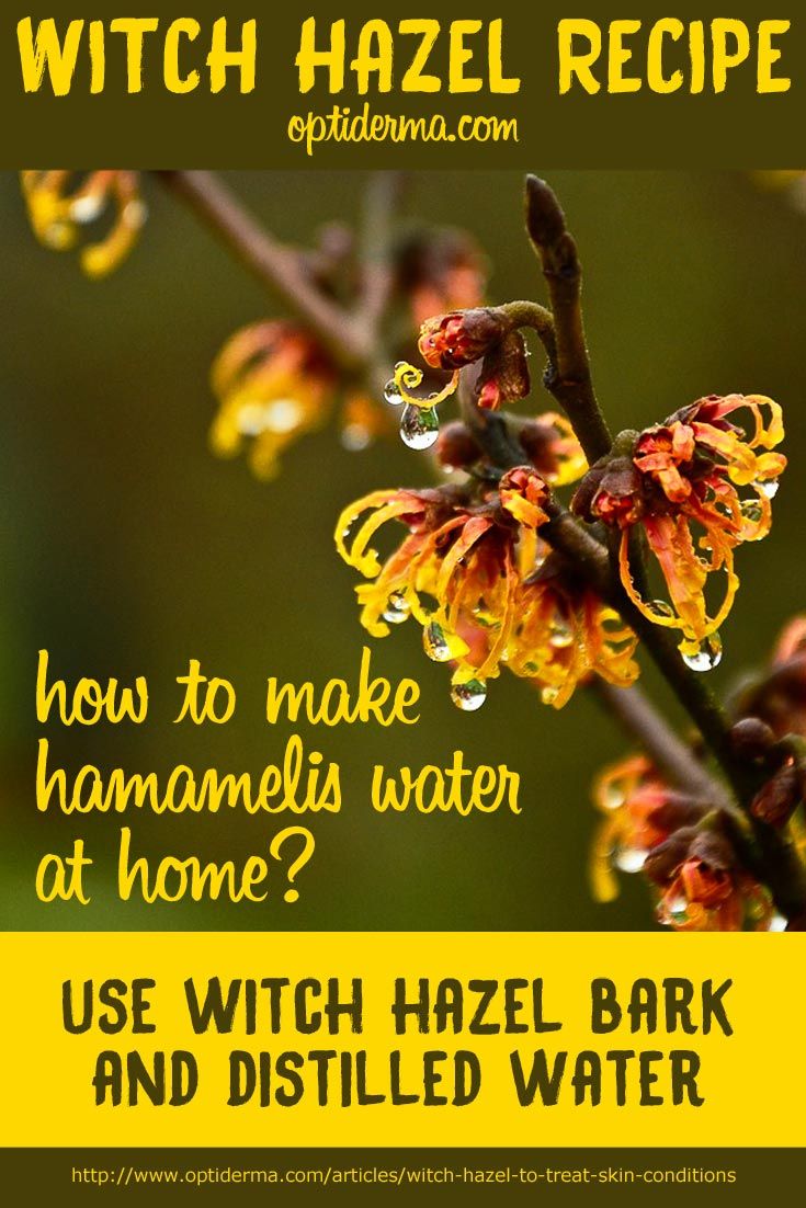 Witch Hazel for Psoriasis &  Eczema: How to Use it?